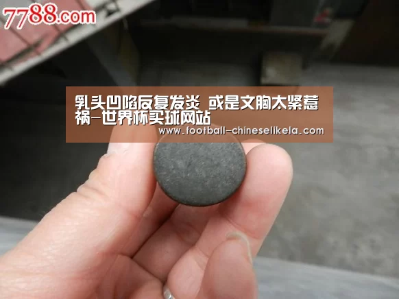 乳头凹陷反复发炎 或是文胸太紧惹祸-世界杯买球网站